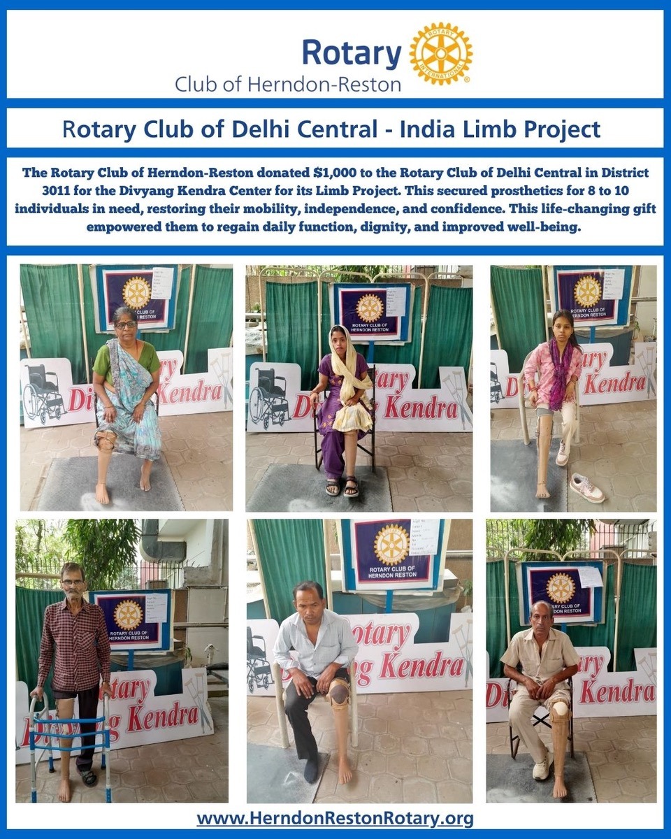 Rotary India Limb Project May 2025-2 Six More Lives Transformed — Rotary Brings Hope Through Mobility